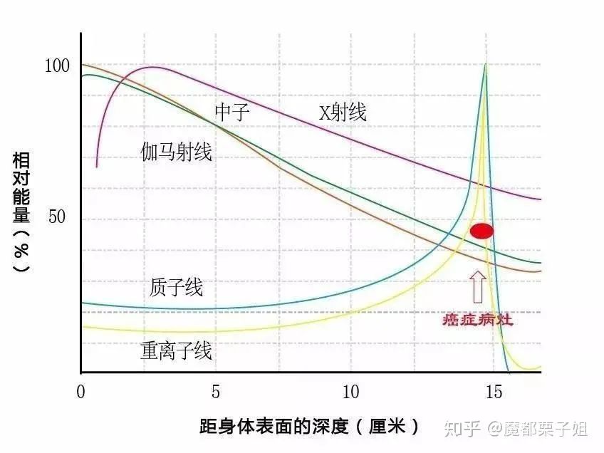 质子重离子治疗的5个热门问题