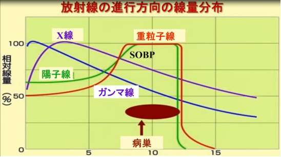 高剂量高精度放疗利器——质子重离子，是骨肉瘤首选的放疗方法！