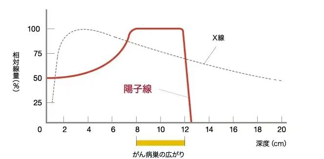 5 年生存率高达80.6%，显著降低毒副作用！质子治疗横纹肌肉瘤优势显著